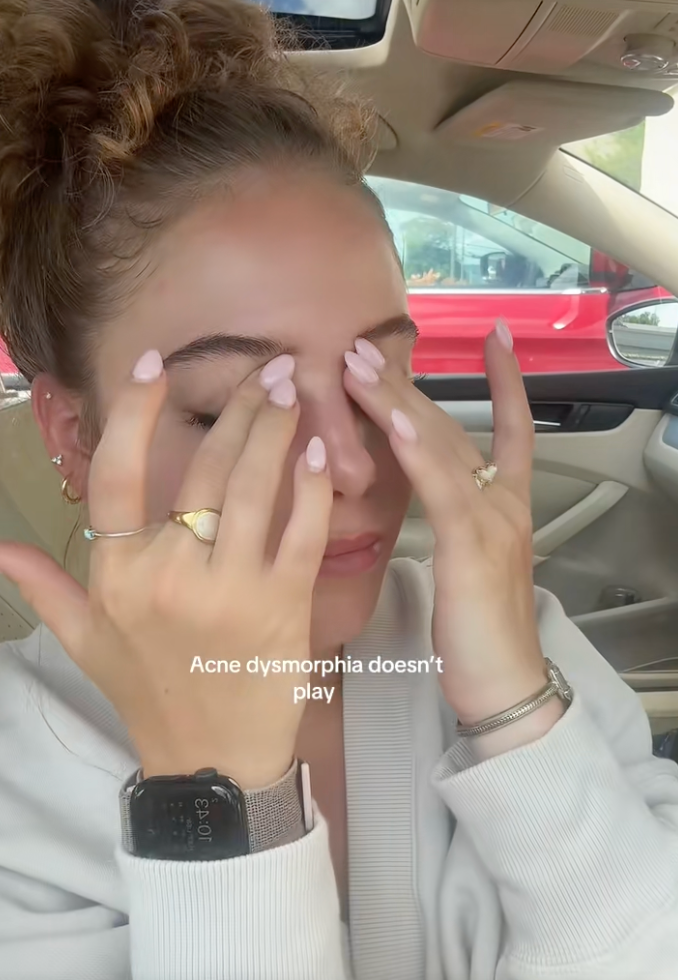 Maddie Ogle shares her experience with skin dysmorphia on TikTok